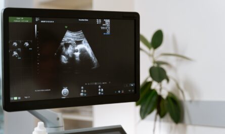 photo of ultrasound testing
